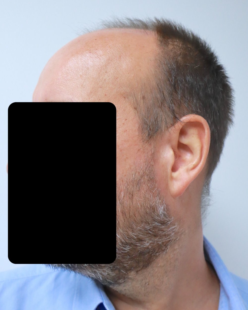 preshave