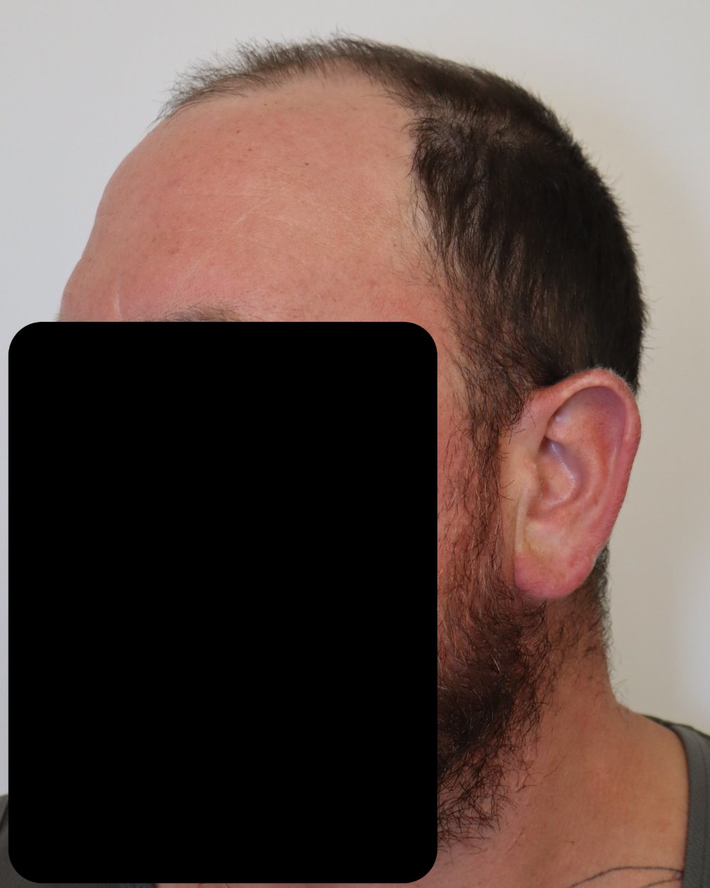 preshave